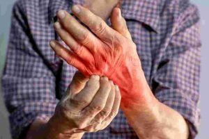 Detection and Treatment of Fungal Skin Infections in “Rumah Singgah” Communities in Jakarta