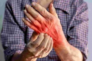 Detection and Treatment of Fungal Skin Infections in “Rumah Singgah” Communities in Jakarta