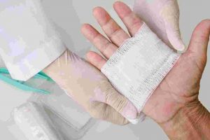 Probiotic Incorporation in Bacterial Cellulose Produced by Komagataeibacter Intermedius for Application on Wound Healing